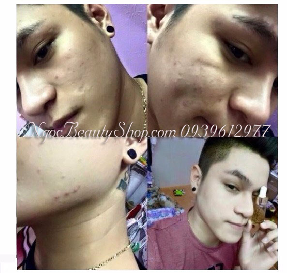 set_serum_bergamo_luxury_gold_collagen_caviar_ngocbeautyshop.com_0939612977_3