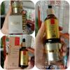 combo-chuyen-sau-tri-nam-tan-nhang-duong-trang-da-san-ei-va-ecotop-24k-gold-collagen-serum - ảnh nhỏ  1
